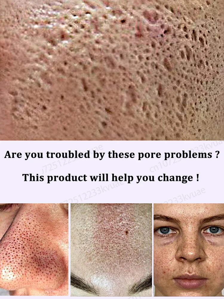 Pore repair essence