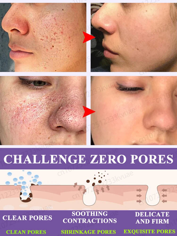 Pore repair essence