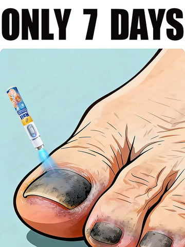 Nail Fungus Treatment Pen