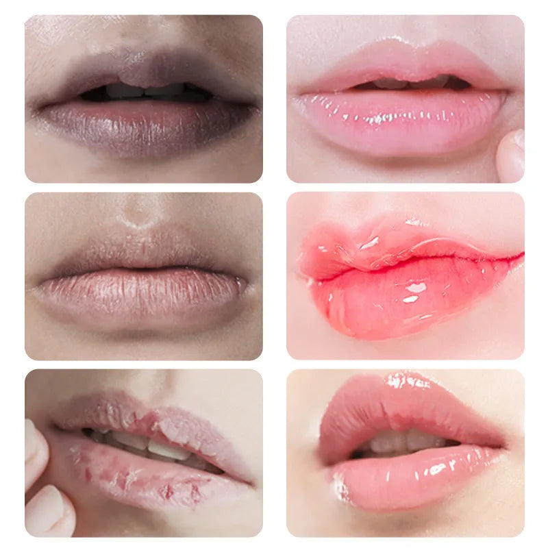 Fast Lightening Pink Mouth Lips Serum